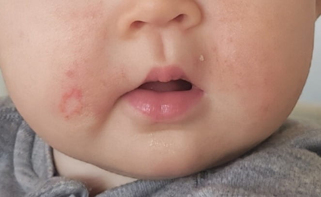 Jälkeen